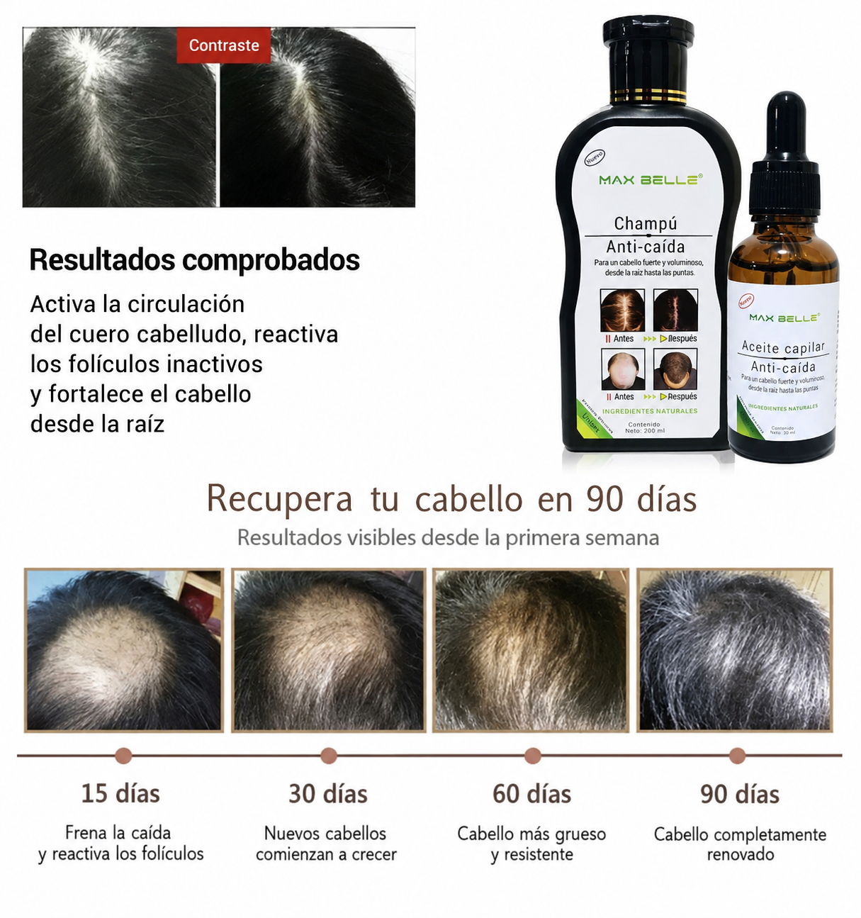 Kit Anticaída Max Belle — Champú + Aceite Capilar