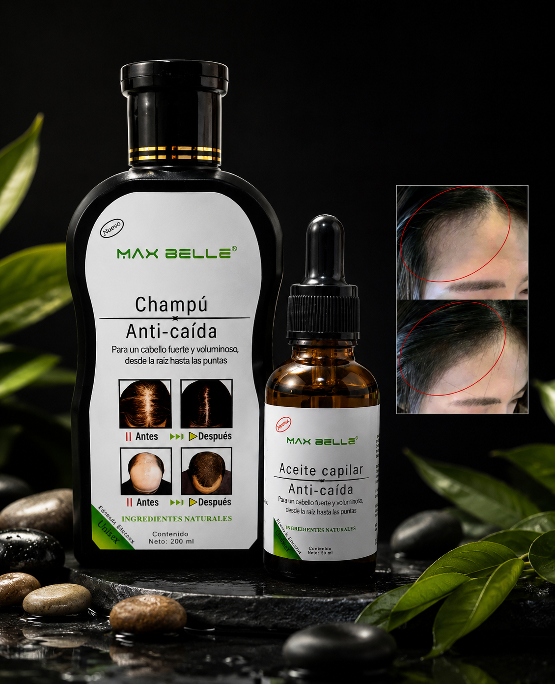 Kit Anticaída Max Belle — Champú + Aceite Capilar